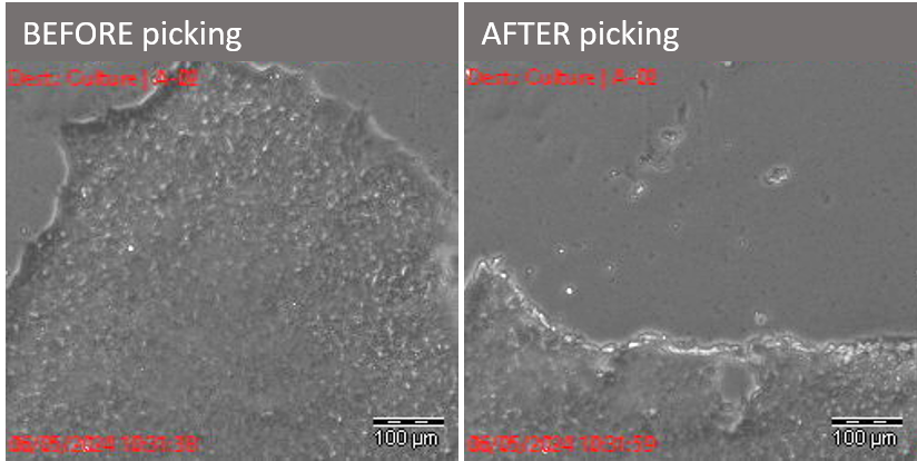 photo iPSC piquée au Cell Celector